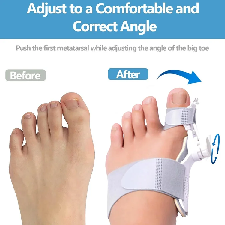 Eicgo Bunion Corrector for Women & Men - Image 3